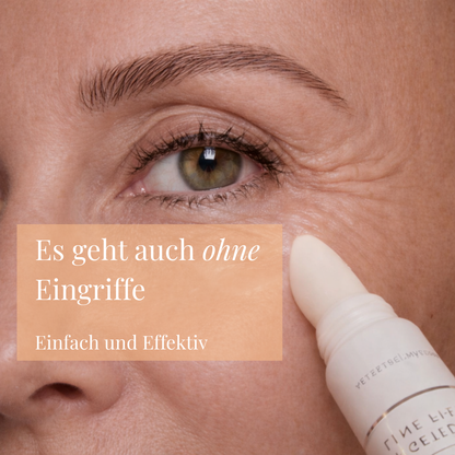 Precision Line Filler