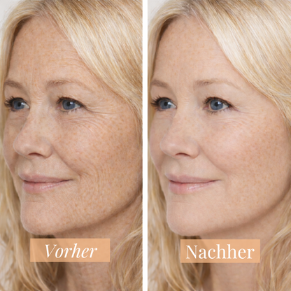 Precision Line Filler