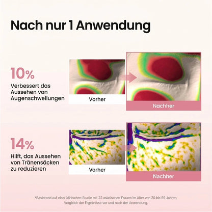 Eyevera PDRN